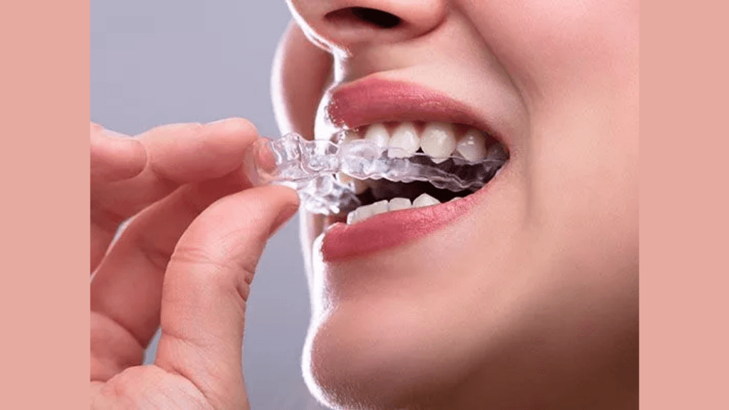 What is a Night Guard?