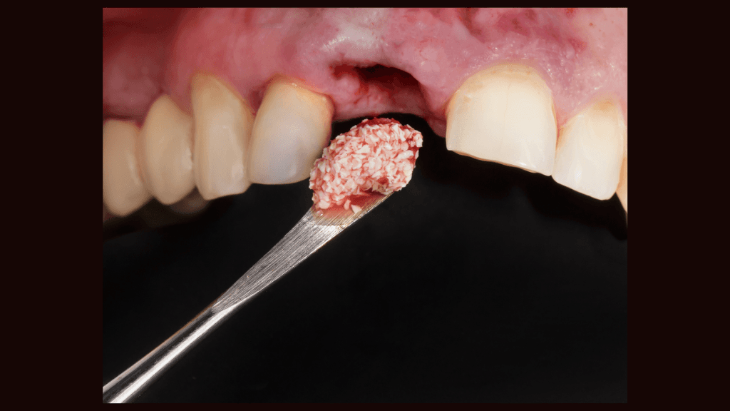 Building a Foundation