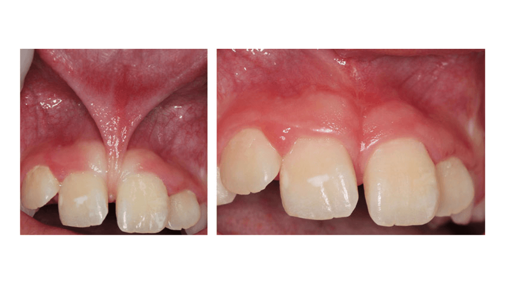 Improving Quality of Life